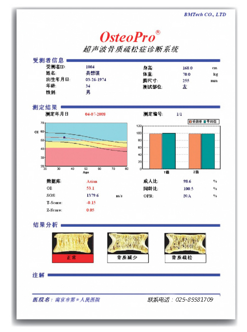 超聲骨密度檢測結果.jpg