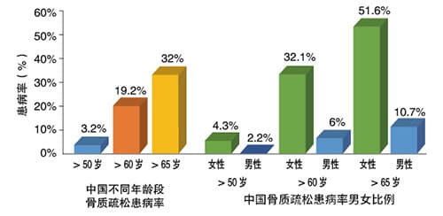 女性骨質(zhì)情況